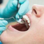 przygotowania-do-wizyty-u-dentysty-na-pradze